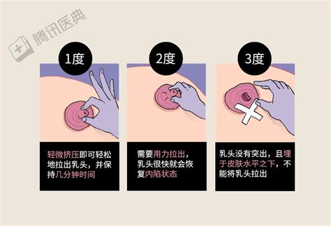 胸部有毛|乳头边上有毛毛正常吗？10 个你需要知道的小问题